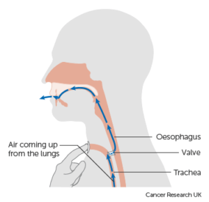 Diagram showing a voice valve between the esophagus and trachea