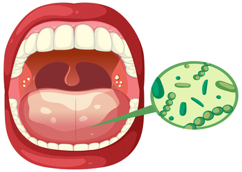 best mouth cancer doctor in Nagpur